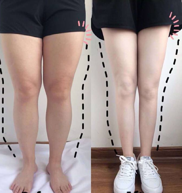 라이프스타일 개선